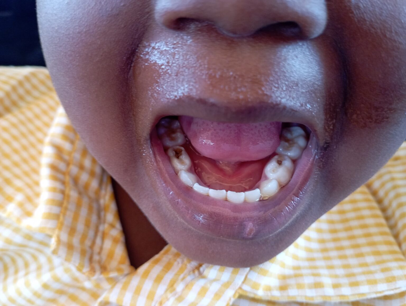 THO dental program THO medical Volunteer outreach 2024